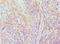 Elongin A antibody, MBS968994, MyBioSource, Immunohistochemistry paraffin image 