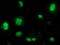 Beta-Transducin Repeat Containing E3 Ubiquitin Protein Ligase antibody, LS-C785673, Lifespan Biosciences, Immunofluorescence image 