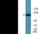 Telomerase Reverse Transcriptase antibody, EKC2328, Boster Biological Technology, Western Blot image 