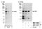 ABL Proto-Oncogene 2, Non-Receptor Tyrosine Kinase antibody, NBP1-18875, Novus Biologicals, Western Blot image 