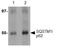 Sequestosome 1 antibody, ab91526, Abcam, Western Blot image 