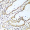 Nudix Hydrolase 15 antibody, A05498, Boster Biological Technology, Immunohistochemistry paraffin image 