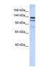 NODAL Modulator 1 antibody, NBP1-79566, Novus Biologicals, Western Blot image 
