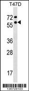 General Transcription Factor IIF Subunit 1 antibody, 59-014, ProSci, Western Blot image 