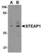 STEAP Family Member 1 antibody, NBP1-76821, Novus Biologicals, Western Blot image 