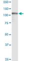 General Transcription Factor IIi antibody, H00002969-M01, Novus Biologicals, Western Blot image 