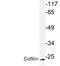 CFL1 antibody, LS-C177632, Lifespan Biosciences, Western Blot image 