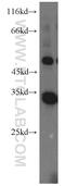 Peroxisomal Biogenesis Factor 7 antibody, 20614-1-AP, Proteintech Group, Western Blot image 