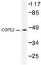 COP9 Signalosome Subunit 3 antibody, LS-C176085, Lifespan Biosciences, Western Blot image 