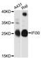 IFI30 Lysosomal Thiol Reductase antibody, LS-C748062, Lifespan Biosciences, Western Blot image 