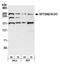 Spectrin Beta, Non-Erythrocytic 2 antibody, A301-117A, Bethyl Labs, Western Blot image 