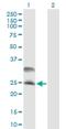 DnaJ Heat Shock Protein Family (Hsp40) Member C5 antibody, H00080331-B01P, Novus Biologicals, Western Blot image 