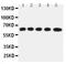 Solute Carrier Family 22 Member 5 antibody, PA2174, Boster Biological Technology, Western Blot image 