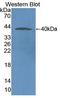 NOX5 antibody, LS-C715757, Lifespan Biosciences, Western Blot image 