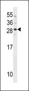 Guanylyl cyclase-activating protein 2 antibody, LS-C157793, Lifespan Biosciences, Western Blot image 