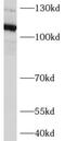 Actin filament-associated protein 1-like 2 antibody, FNab00194, FineTest, Western Blot image 