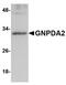 Glucosamine-6-Phosphate Deaminase 2 antibody, NBP1-76997, Novus Biologicals, Western Blot image 