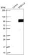 Erythrocyte Membrane Protein Band 4.1 Like 5 antibody, PA5-58008, Invitrogen Antibodies, Western Blot image 
