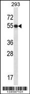 General Transcription Factor IIE Subunit 1 antibody, 57-730, ProSci, Western Blot image 