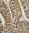 Microsomal triglyceride transfer protein large subunit antibody, abx034212, Abbexa, Immunohistochemistry paraffin image 