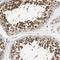 RuvB Like AAA ATPase 1 antibody, NBP1-84913, Novus Biologicals, Immunohistochemistry frozen image 