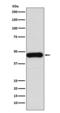 DnaJ Heat Shock Protein Family (Hsp40) Member A1 antibody, M04151, Boster Biological Technology, Western Blot image 