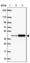 DnaJ Heat Shock Protein Family (Hsp40) Member B1 antibody, NBP2-38988, Novus Biologicals, Western Blot image 