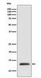 Ring-Box 1 antibody, M00524, Boster Biological Technology, Western Blot image 