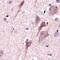 Corticotropin Releasing Hormone antibody, PA5-32364, Invitrogen Antibodies, Immunohistochemistry paraffin image 