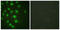 Cyclin Dependent Kinase Inhibitor 1C antibody, LS-C199385, Lifespan Biosciences, Immunofluorescence image 