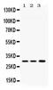 Aquaporin-11 antibody, PA5-78807, Invitrogen Antibodies, Western Blot image 