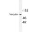 Vinculin antibody, LS-C176564, Lifespan Biosciences, Western Blot image 