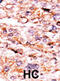 Activin A Receptor Type 2A antibody, abx033181, Abbexa, Immunohistochemistry paraffin image 