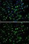 Adenylate Kinase 4 antibody, GTX30038, GeneTex, Immunofluorescence image 