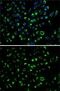 Adenylate kinase isoenzyme 4, mitochondrial antibody, GTX30038, GeneTex, Immunofluorescence image 