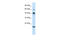 Zinc Finger Protein 24 antibody, 27-876, ProSci, Western Blot image 