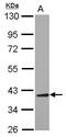 Aminoacyl TRNA Synthetase Complex Interacting Multifunctional Protein 2 antibody, GTX118650, GeneTex, Western Blot image 
