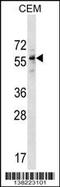 Diphthamide Biosynthesis 2 antibody, 59-759, ProSci, Western Blot image 