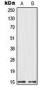 Mitochondrial Ribosomal Protein L14 antibody, LS-C353537, Lifespan Biosciences, Western Blot image 