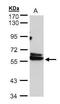 Chaperonin Containing TCP1 Subunit 4 antibody, GTX103795, GeneTex, Western Blot image 