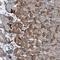 AXL Receptor Tyrosine Kinase antibody, NBP2-38345, Novus Biologicals, Immunohistochemistry frozen image 