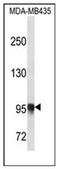 Procollagen-Lysine,2-Oxoglutarate 5-Dioxygenase 3 antibody, AP53355PU-N, Origene, Western Blot image 