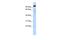 SH2B Adaptor Protein 1 antibody, PA5-44302, Invitrogen Antibodies, Western Blot image 