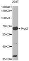 Paired Box 7 antibody, LS-C747822, Lifespan Biosciences, Western Blot image 