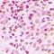 Myosin VI antibody, orb214291, Biorbyt, Immunohistochemistry paraffin image 