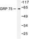 Heat Shock Protein Family A (Hsp70) Member 9 antibody, LS-C176048, Lifespan Biosciences, Western Blot image 