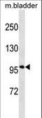 Ectonucleotide pyrophosphatase/phosphodiesterase family member 1 antibody, LS-C157907, Lifespan Biosciences, Western Blot image 