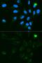 UDP Glucuronosyltransferase Family 1 Member A9 antibody, GTX33571, GeneTex, Immunofluorescence image 