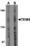 Rho Guanine Nucleotide Exchange Factor 17 antibody, GTX85788, GeneTex, Western Blot image 