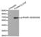 Interferon Alpha And Beta Receptor Subunit 1 antibody, LS-C336003, Lifespan Biosciences, Western Blot image 